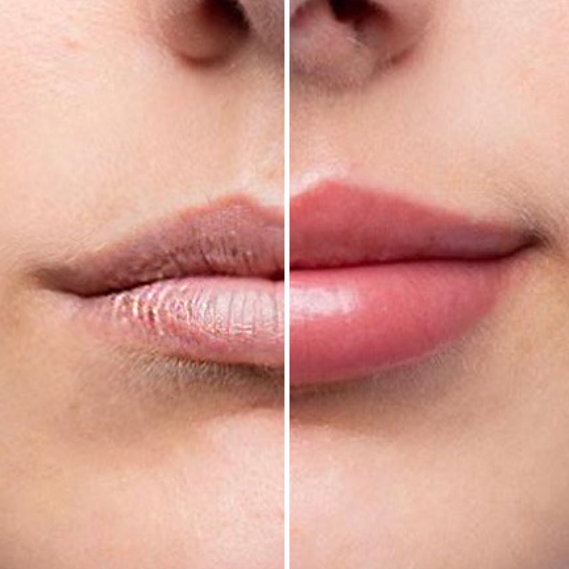 Serum powiększające usta - Magic Lips